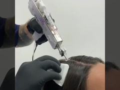 U225 Draagbare Mesotherapie Geweer Huidtherapie Schoonheidsapparaat Gezichtsverzorging Nog geen reviews